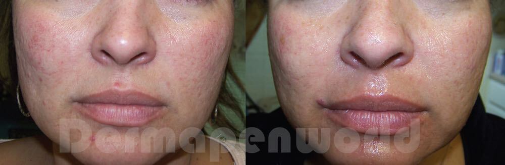 f7e26759-07c1-474f-bc1a-46bdfd6015e2